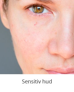 Sensitiv hud